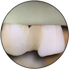 Регулировочные механизмы VarioFocus и эргономика