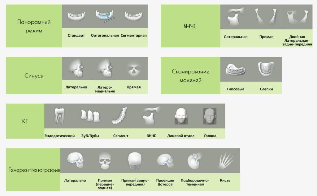 Genoray Papaya 3D Plus — качество изображения и автоматические программы сканирования