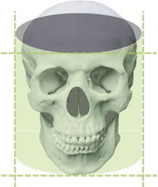 FOV 4×4 / 5×5 — эндо и одиночный имплантат