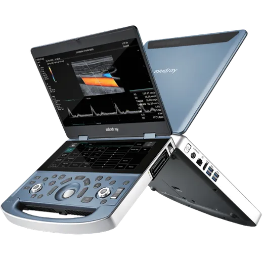 Mindray MX7 Beauty