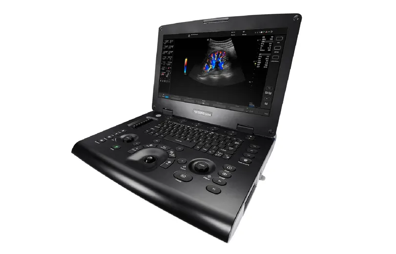 GE Healthcare Versana Active