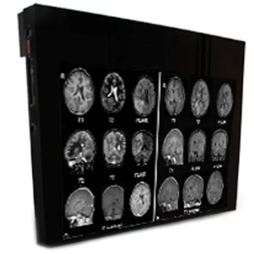 Double Black Imaging 24″ MRSafe Display