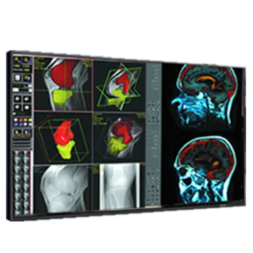 Double Black Imaging 42″ Professional LCD