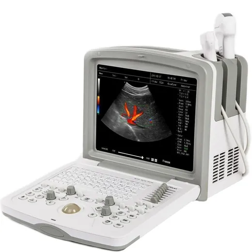 Acuvista RS880d 12&amp;quot;