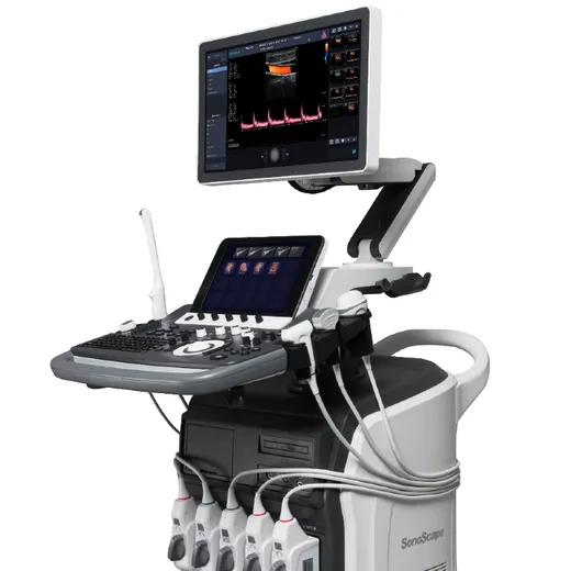 Sonoscape S40