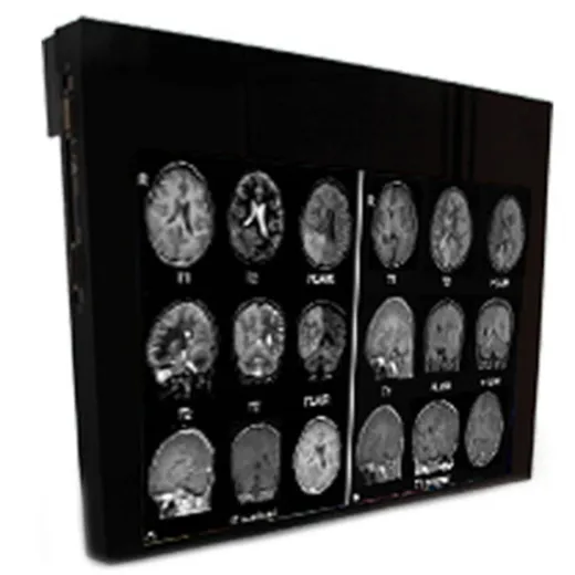 Double Black Imaging 32″ MRSafe Display