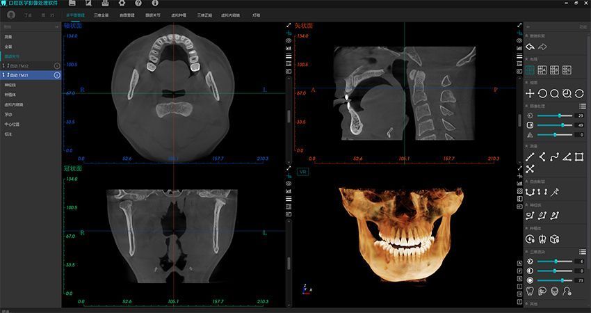 Интерфейс MyDent Viewer 3D