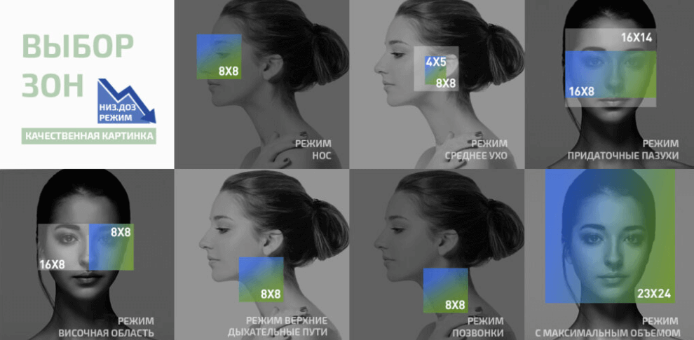 Papaya 3D Plus — свободный выбор FOV и разрешения