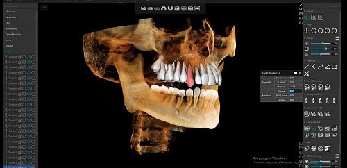 3d томограф Meyer